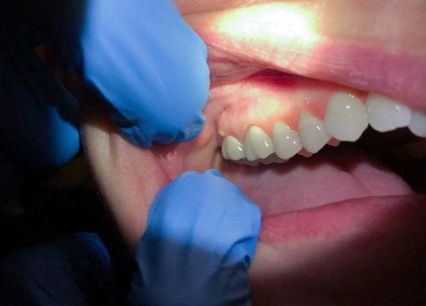 Best Same-Day Emergency Dentist in Brookneal, VA